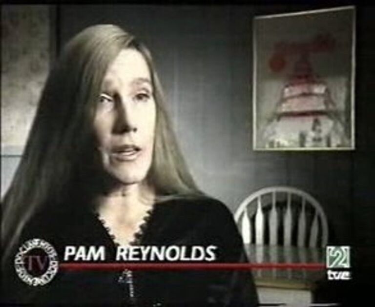 Pam Renolds - Witnessed Every Detail Of Her Surgery 1
